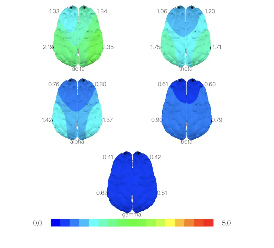 Electrophysiology Neuroscience